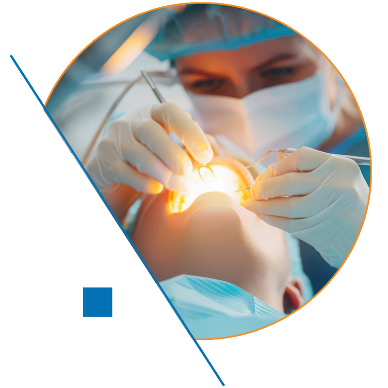 Oralchirurgie Zystenoperationen