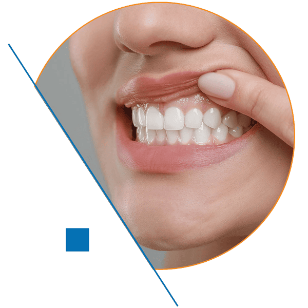 Behandlung Teaserbild Parodontologie